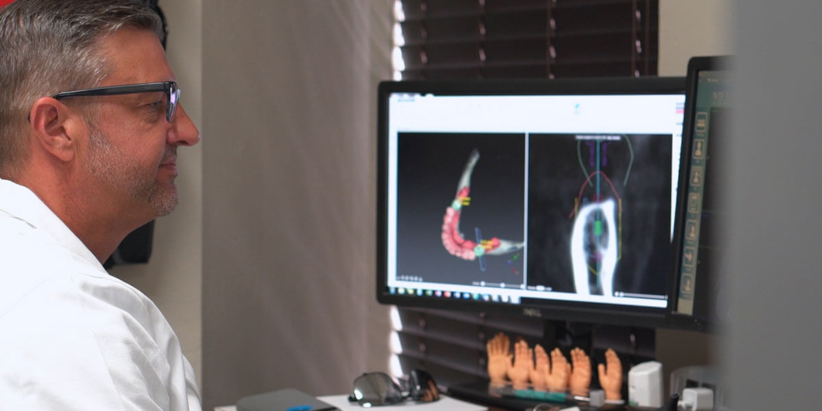 Guided Dental Implant Placement in OKC