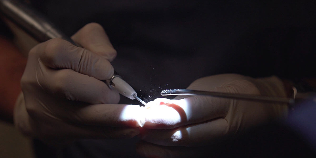 Lasers in Dentistry