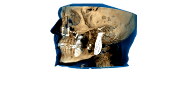 Oral Surgery Technology